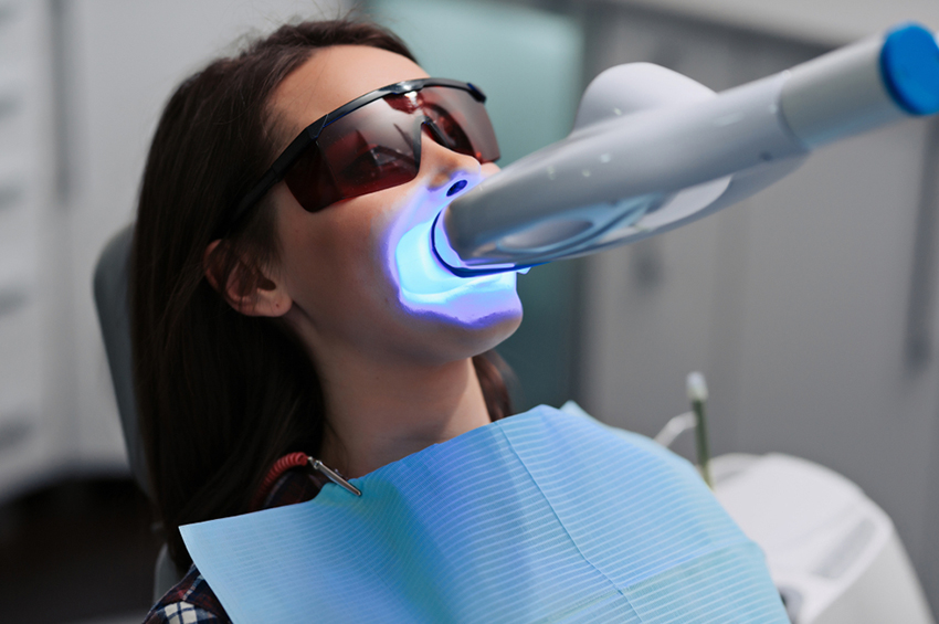 5 Best Reasons Why You Should Consider Teeth Whitening Treatment
